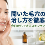 開いた毛穴の治し方を徹底解説。今日からできるスキンケアと生活習慣