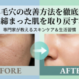 たるみ毛穴の改善方法を徹底解説！引き締まった肌を取り戻す秘訣