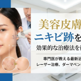 美容皮膚科でニキビ跡を改善！効果的な治療法を徹底解説。