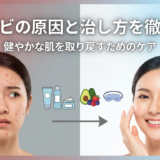 赤ニキビの原因と治し方を徹底解説。健やかな肌を取り戻すためのケア。