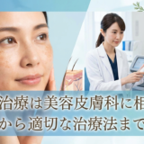 肝斑治療は美容皮膚科に相談を。原因から適切な治療法まで解説